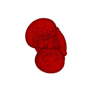 Scots pine (Pinus sylvestris) pollen