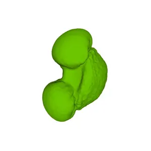 Pine (Pinus sp.) pollen grain