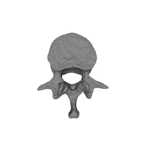 Visible Human Male - First lumbar vertebra