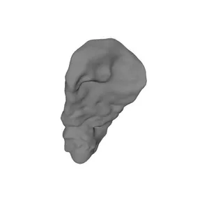 Palatine Tonsil, Male, Right