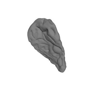 Palatine Tonsil, Female, Left