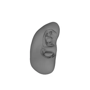 Kidney, Male, Right