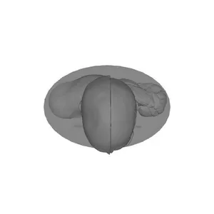 Visible Human Male Bust
