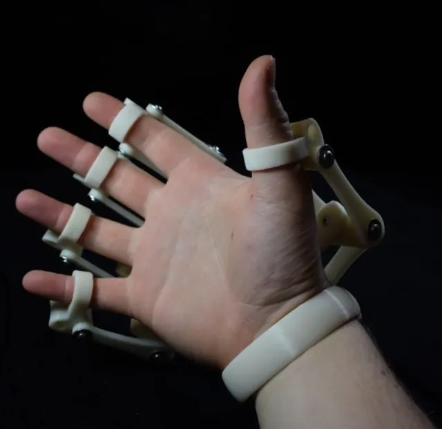3D Printed Exoskeleton Hands — Фото 3 из 12