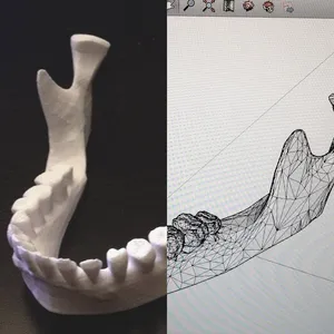 Jaw