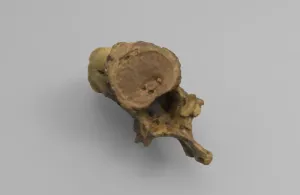 Model of ankylosis in thoracic vertebrae