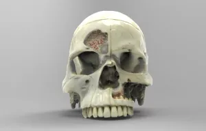 Model shows nerves of the human skull