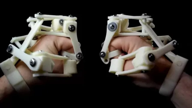 3D Printed Exoskeleton Hands — Image 3 of 6