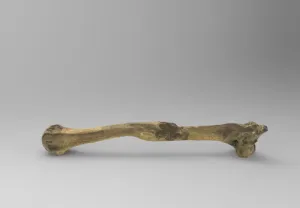 Left humerus to fracture and arthritis