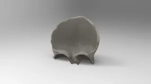 Frontal bone