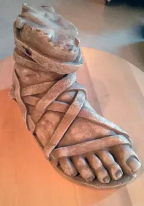 The Leg of Achilles