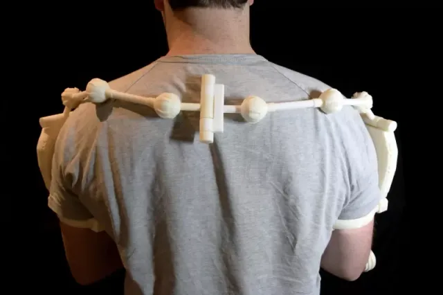 3D Printed Exoskeleton Arms — Image 7 of 11