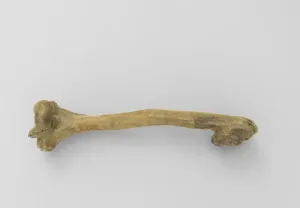 Right Humerus with Assimilation of the Head