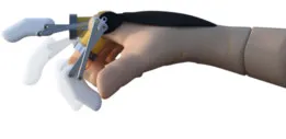 3D PRINTED PROSTHETIC FINGER