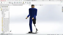 Prosthetic Leg