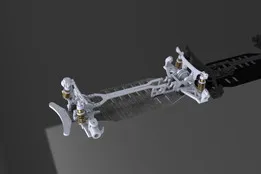 RC Xray T2’009