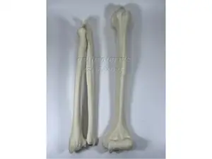 Left Arm Bones