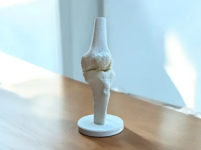 Anatomical Knee Model (from real CT)