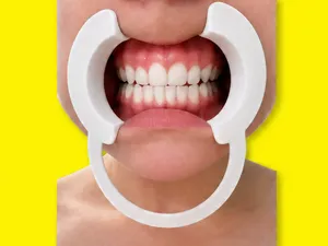 Dental Cheek Retractor ergonomic and flexible