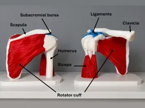 NO AMS Anatomical Shoulder Joint (CT scan)