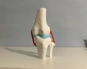 Knee with Meniscus and Collateral Ligaments