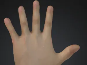 Hand