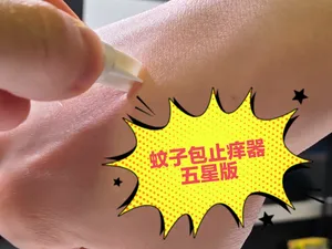 蚊虫叮咬止痒器—五星版（仅需2g）