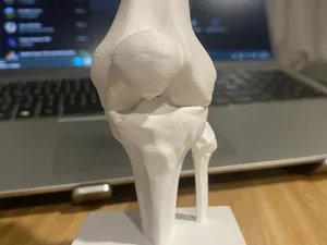 Rodilla de repuesto