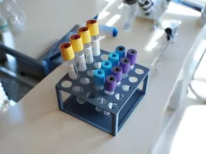 Ultimate Test Tube Rack