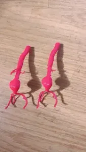 Abdominal Aortic Aneurysm (AAA) - 1:1 Anatomical Scale