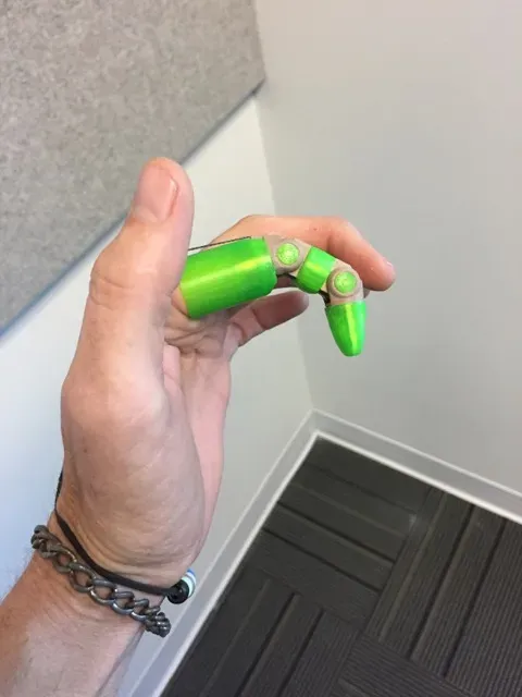 Knick Prosthetic Finger v 3.5.5