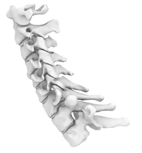 Rigid Spine