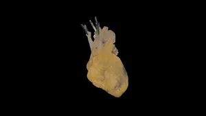 Fixed Human Heart Donation