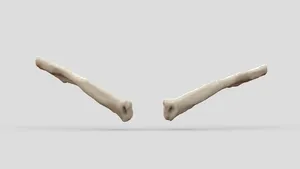 Left and Right Clavicles 18yo male