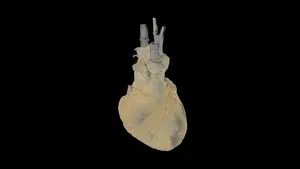 Perfusion Fixed Human Heart Donation #584
