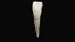 Incisivo central mandibular derecho (4.1)