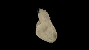 Fixed Human Heart with long Aorta