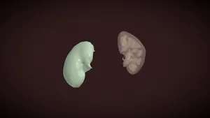 CTACardio Segmentation