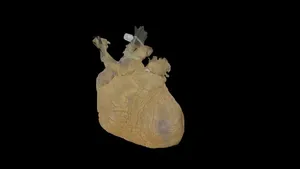 Fixed Human Heart Donation #115