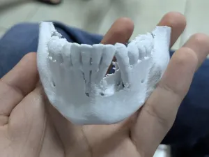 Mandibula Real de Ecografia