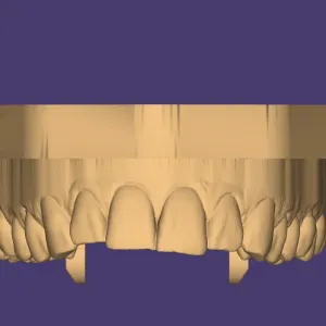 modelos dentales