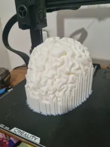cerebro escala real