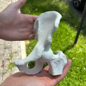 Human Hip (From REAL CT scan)